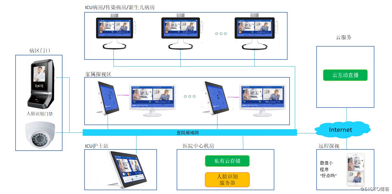 ICU探视对讲的参数